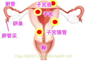 子宮筋腫の解説画像